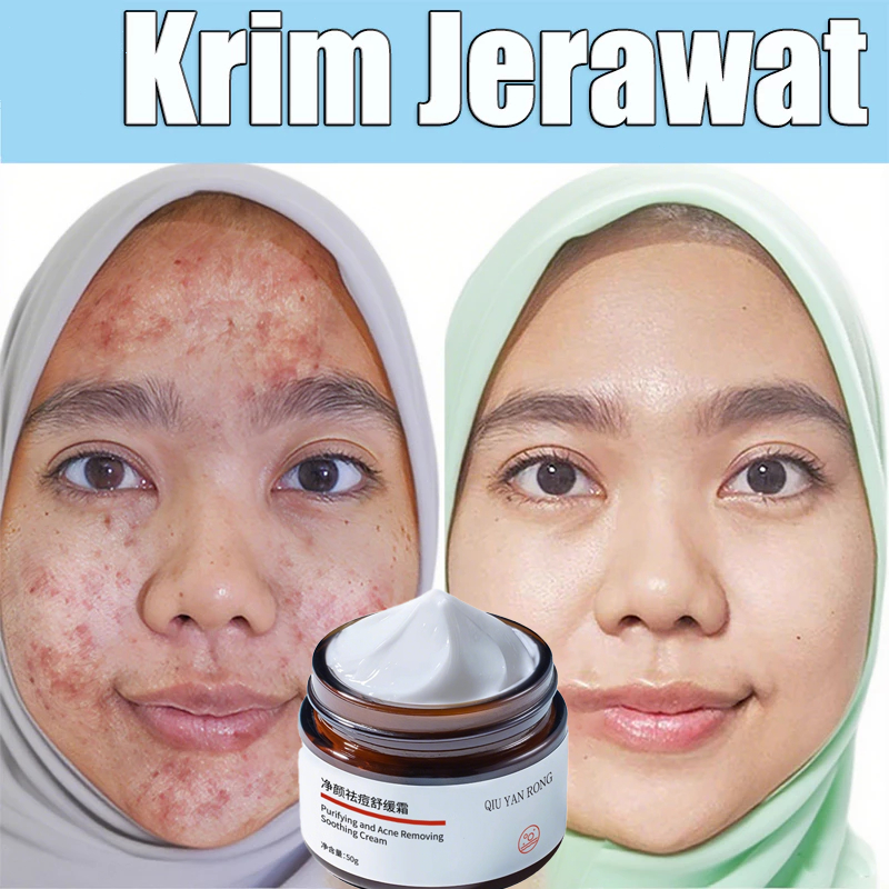 obat bekas jerawat obat jerawat obat penghilang jerawat obat jerawat dan bekas jerawat penghilang je