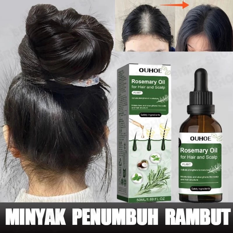 serum rambut rontok serum penumbuh rambut hair serum penumbuh rambut serum rambut penumbuh rambut ro