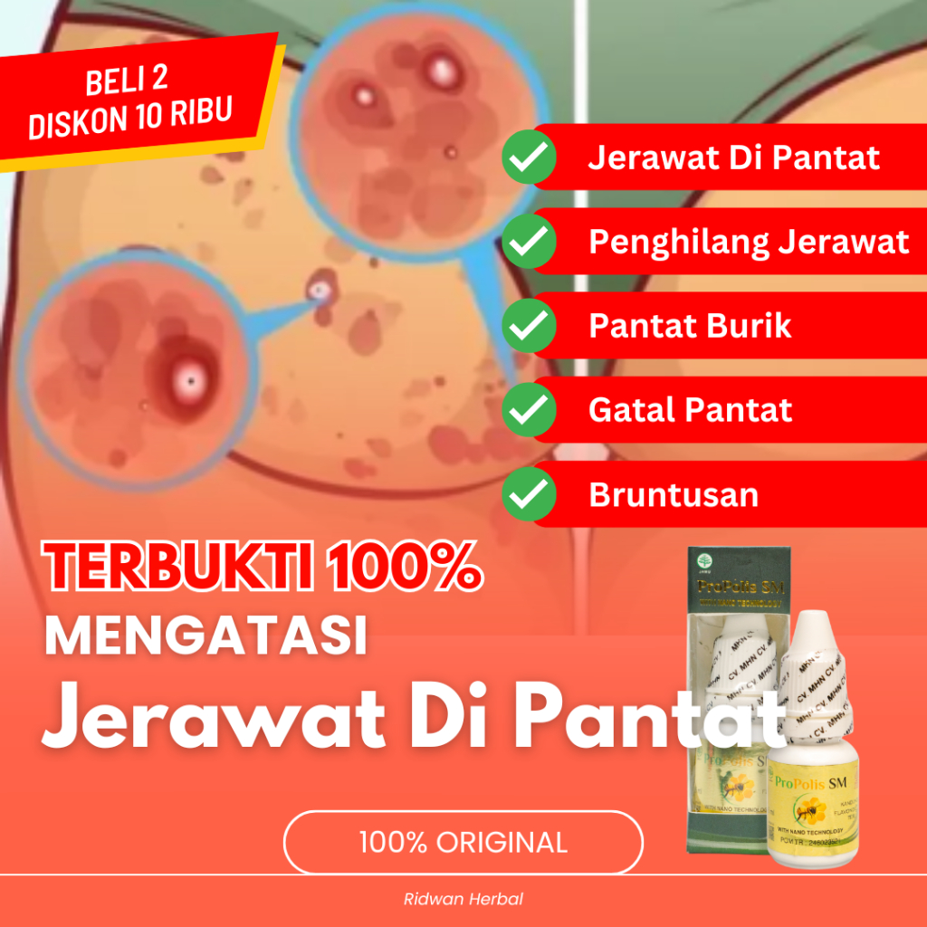 Obat benjolan seperti jerawat di dekat anus, folikulitis, bisul, kista pilonidal, atau abses periana