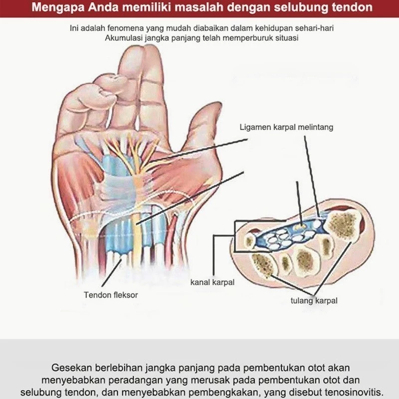 Obat Asam Urat Super Ampuh Salep Asam Urat 30g Gel Cream Obat Radang Sendi Nyeri Sendi Sakit Pinggan