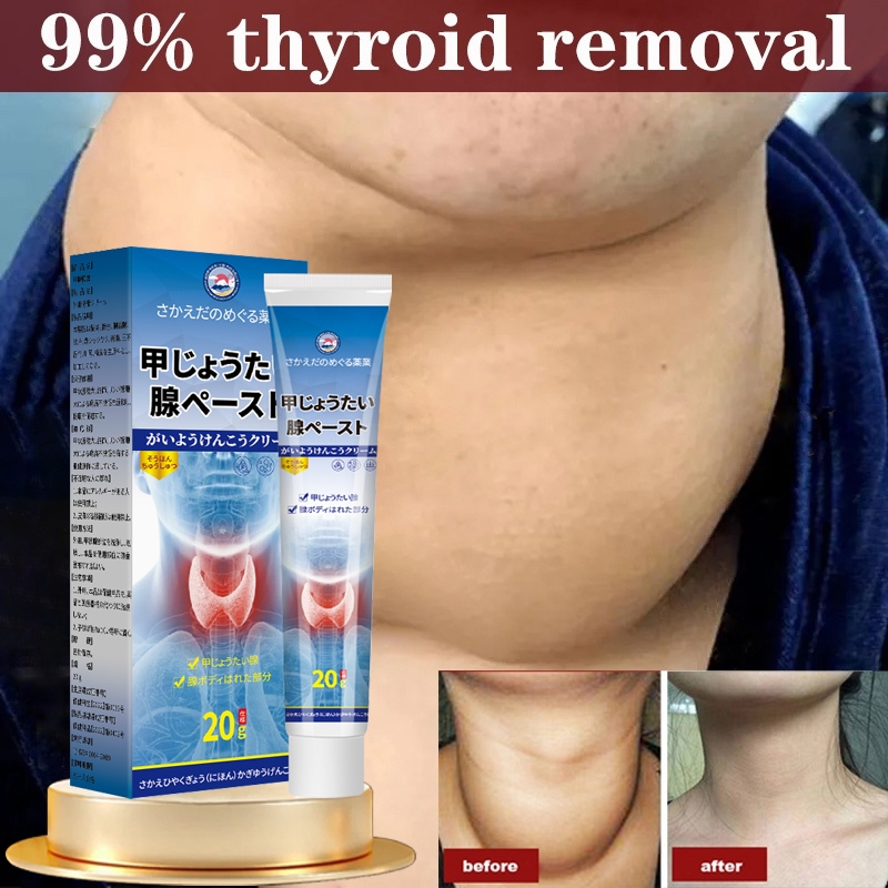 Produk asli Jepang Obat Kelenjar Tiroid 20g  Gondok Beracun Hipertiroid Hipotiroid Benjolan Kelenjar