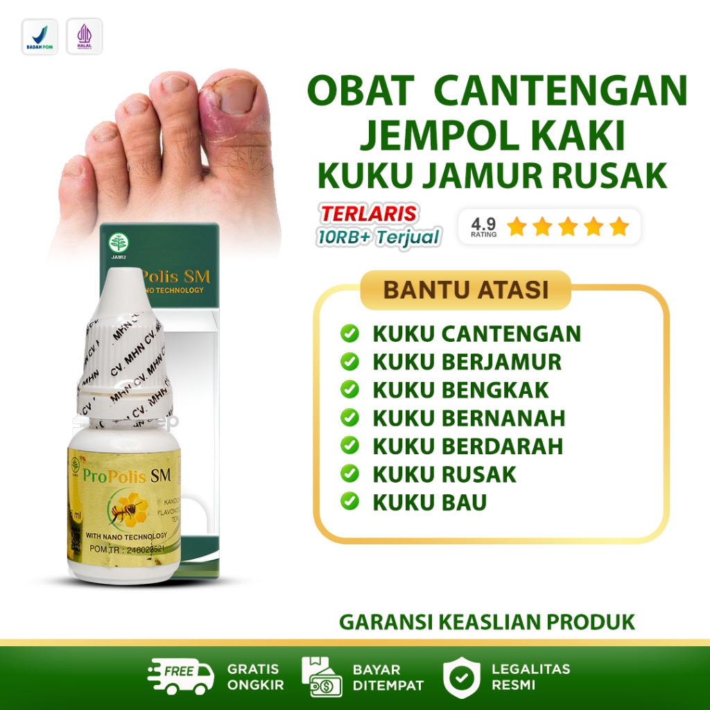 Obat Cantengan Jempol Kaki Obat Jamur Kuku Obat Kuku Rusak Bengkak Berdarah Bernanah Obat Kuku Pembe