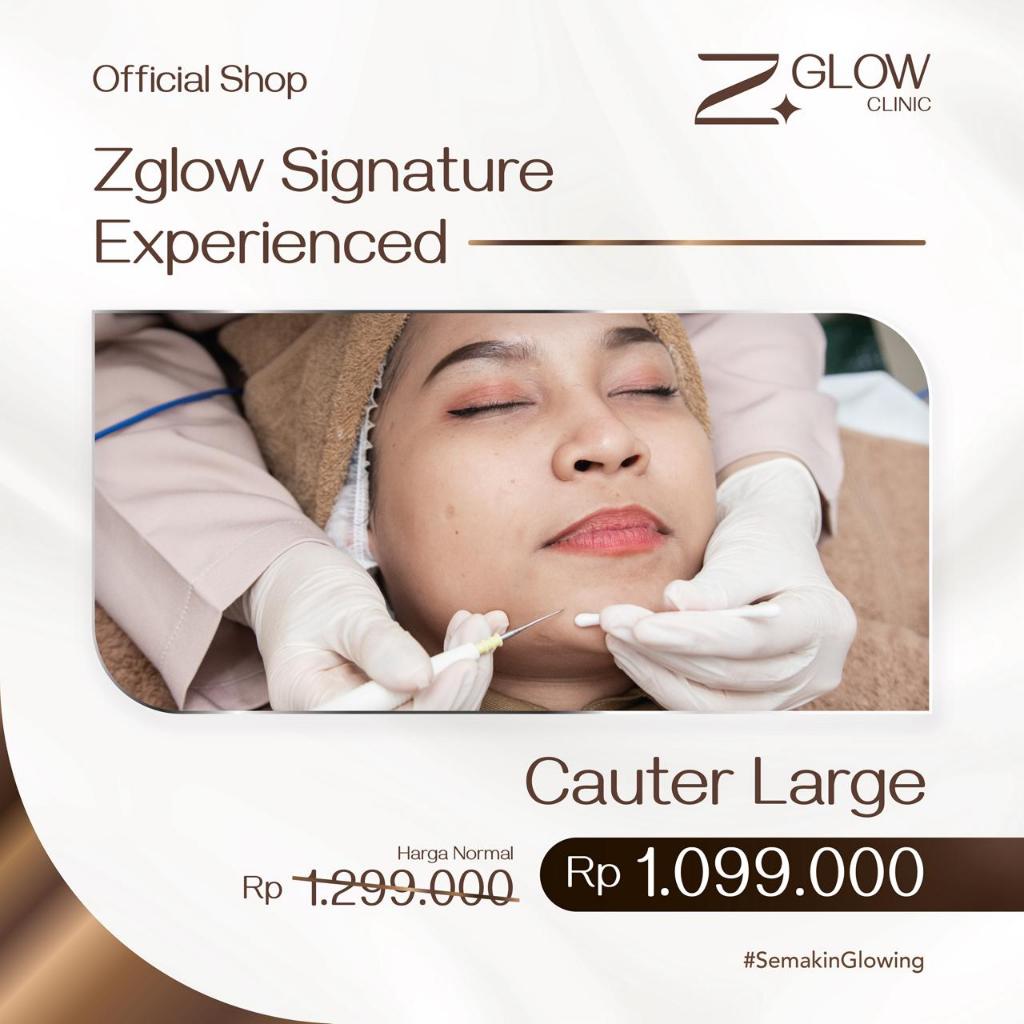 ZGLOW CAUTER LARGE TREATMENT