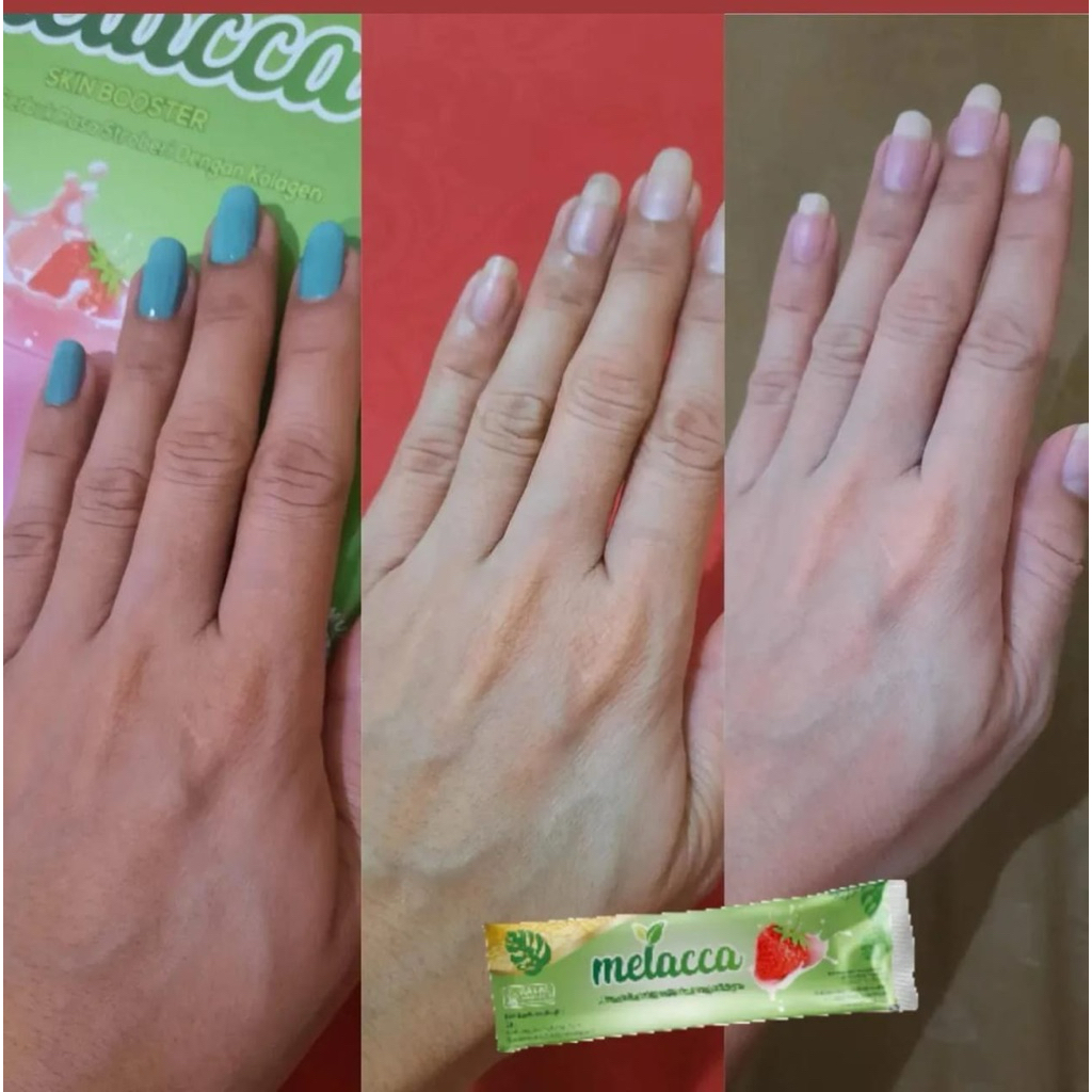 KOLAGEN MELACCA SKIN BOOSTER | Collagen Melacca Gowa Makassar