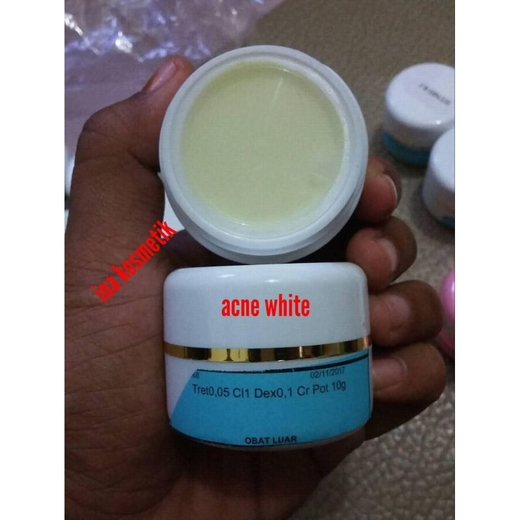 cream malam acne white theraskin