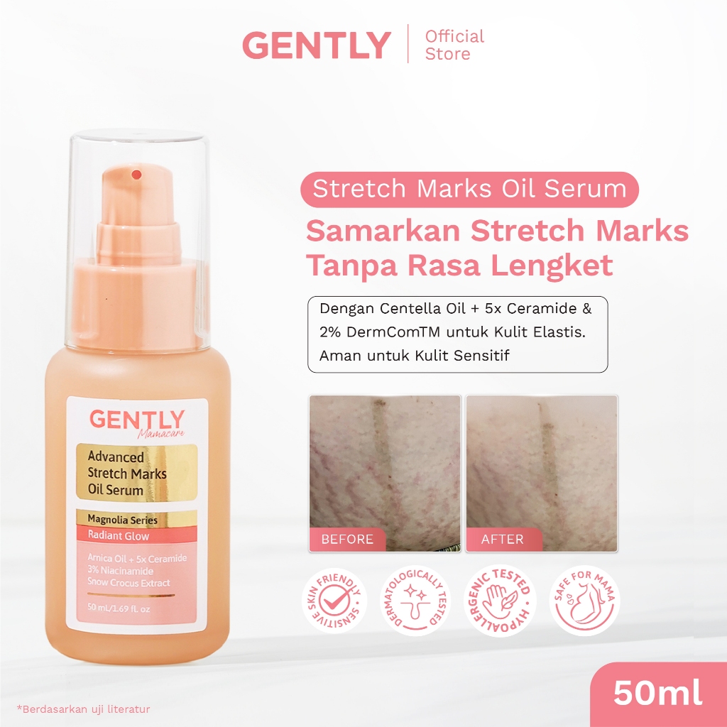 GENTLY Mamacare Advanced Stretch Marks Oil Serum | Arnica Oil + 5x Ceramide + Magnolia Extract + 3% 