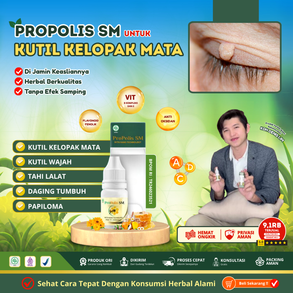 Obat Penghilang Papiloma di Kelopak Mata - Penghilang Kutil - Obat Daging Tumbuh di Mata dan Wajah