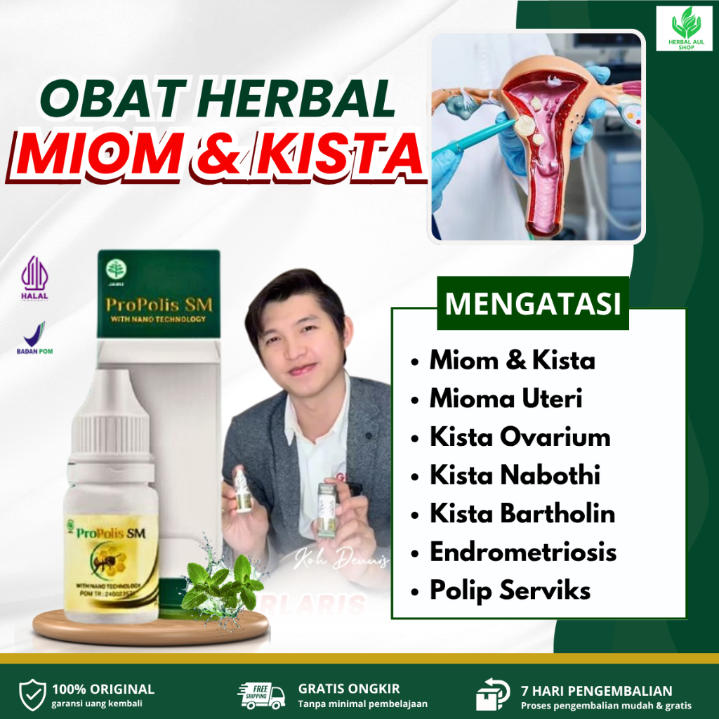 Propolis SM Solusi Untuk Miom & Kista, Mioma Uteri, Kista Ovarium, Kista Nabothi, Kista Bartholin, E