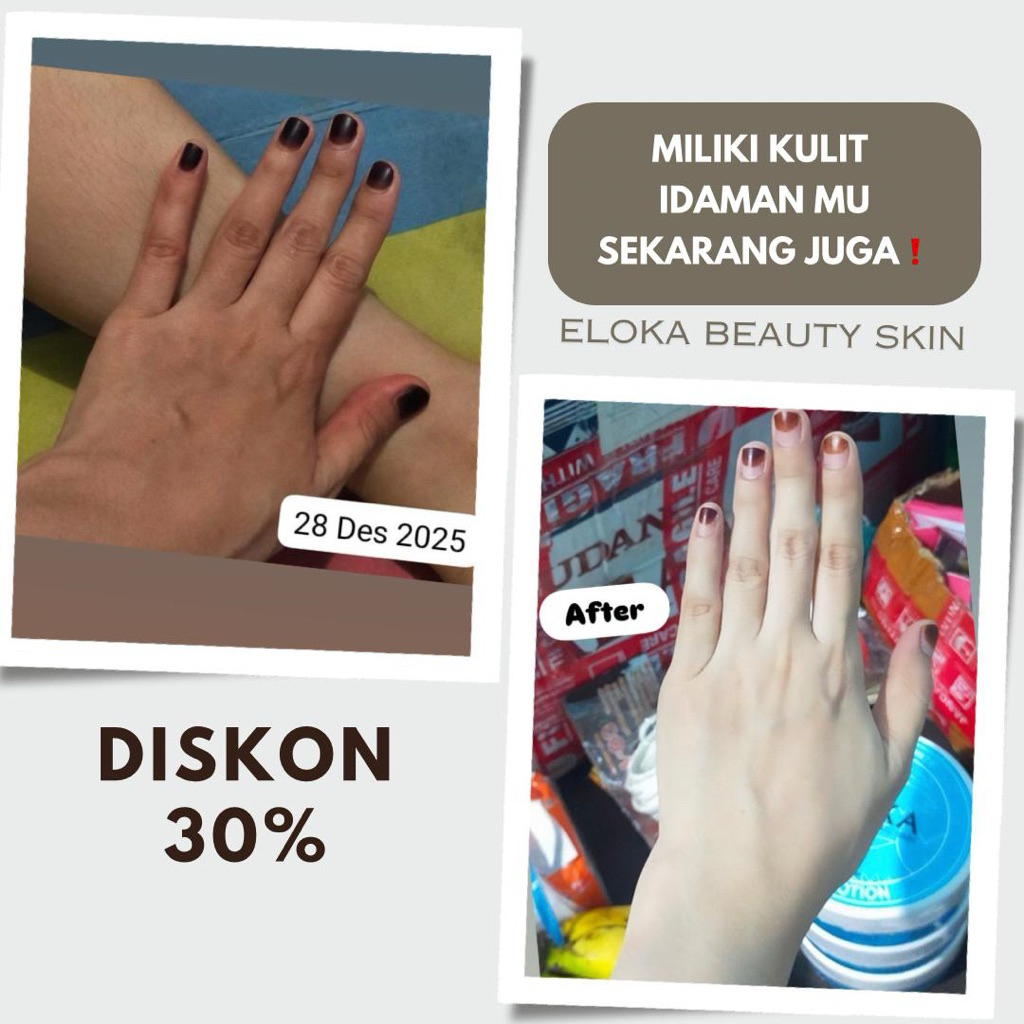 ELOKA BODYLOTION