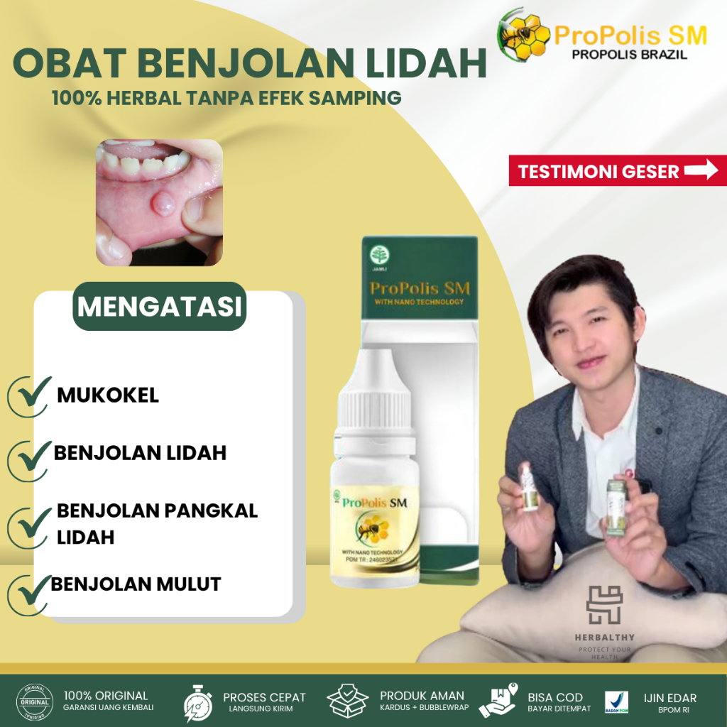 Obat Kelenjar Mukokel, Obat Herbal Pengempis Benjolan di  Lidah,  Obat Lidah Luka-Luka, Obat Kanker 