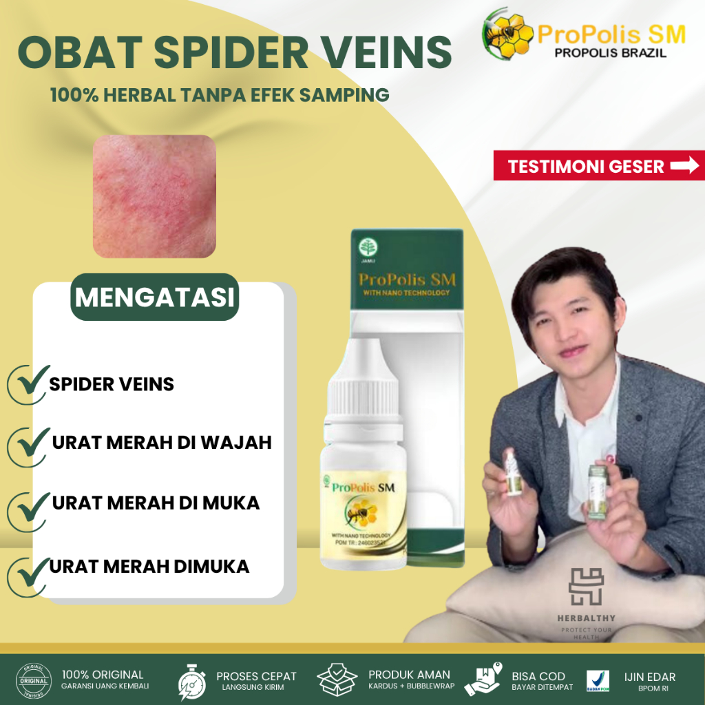 Obat Penghilang Urat Halus di Wajah Spider Veins Obat Oles Penghilang Spider Veins Urat Merah Di Waj