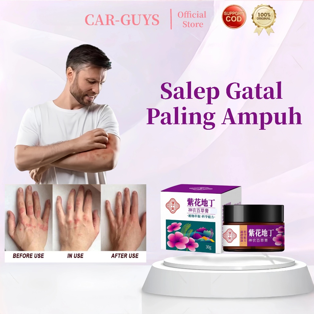 CAR GUYS Salep Eksim Kering,Gatal Selangkangan Salep Bayi Untuk Kulit Iritasi Psoriasis Cream