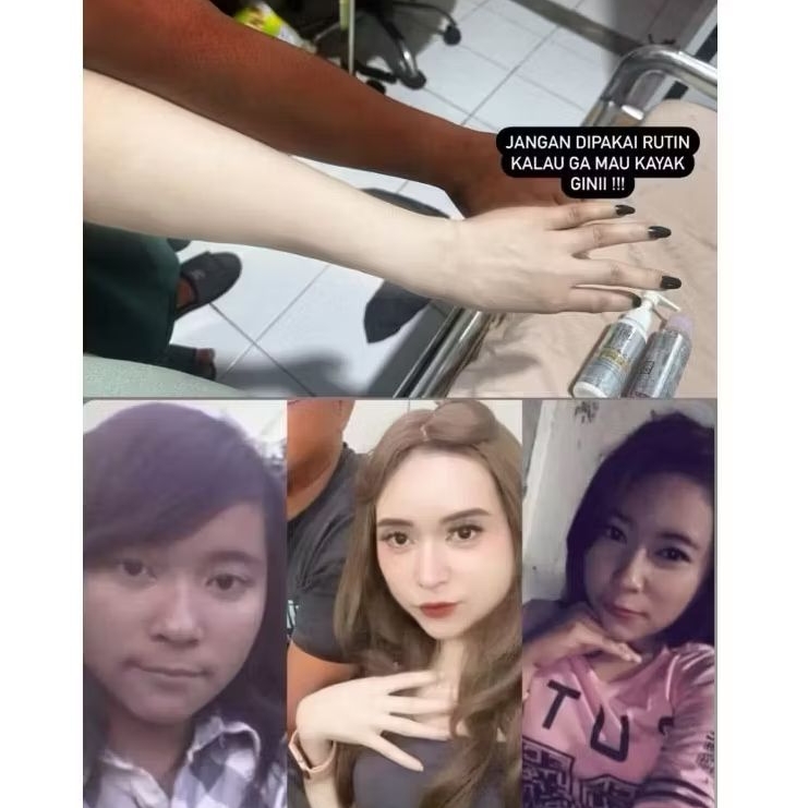 TONER BADAN ( NEW BPOM ) PENGELUPASAN SUPER STRONG / TONER BADAN HITAM / BODY TONER DOSTING
