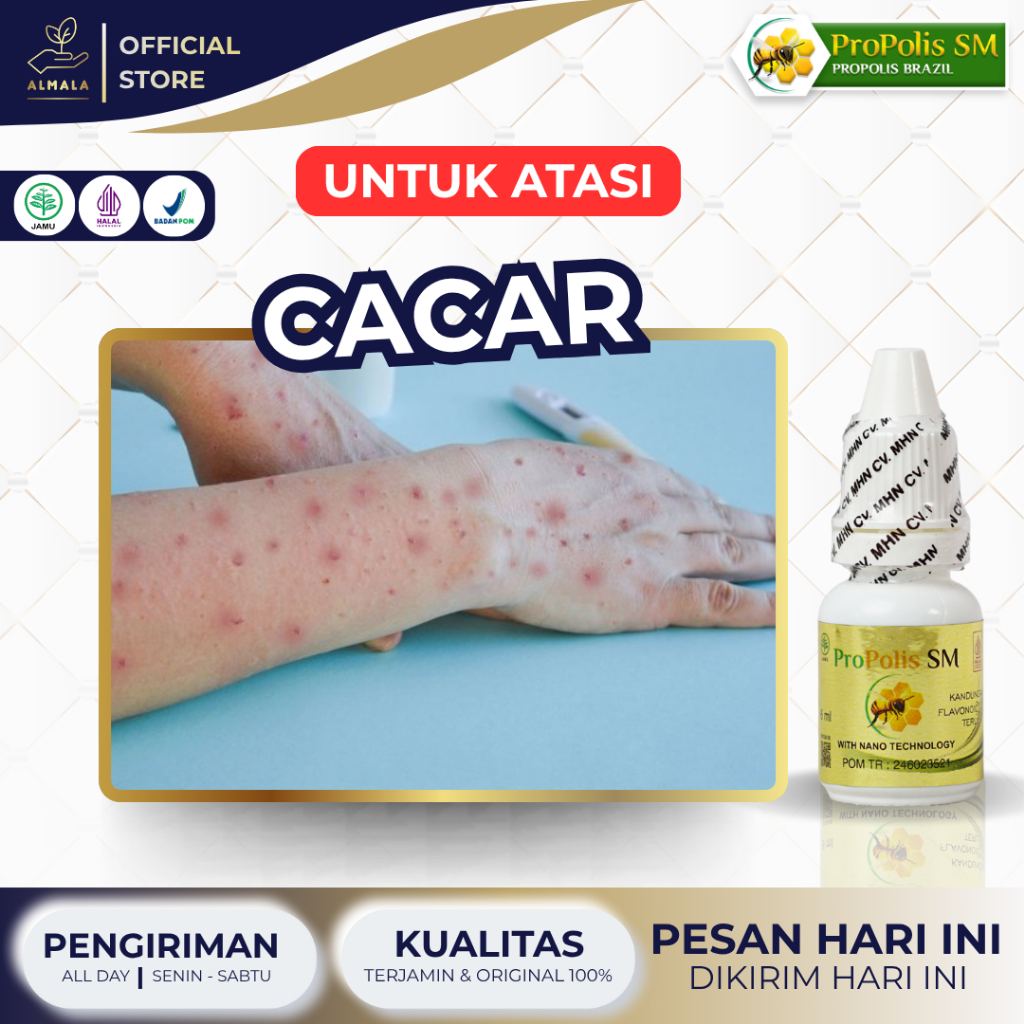 Propolis SM Obat Cacar, Obat herpes, Obat Cacar Air, Salep Cacar Anak, Salep Cacar Dewasa, Obat Caca