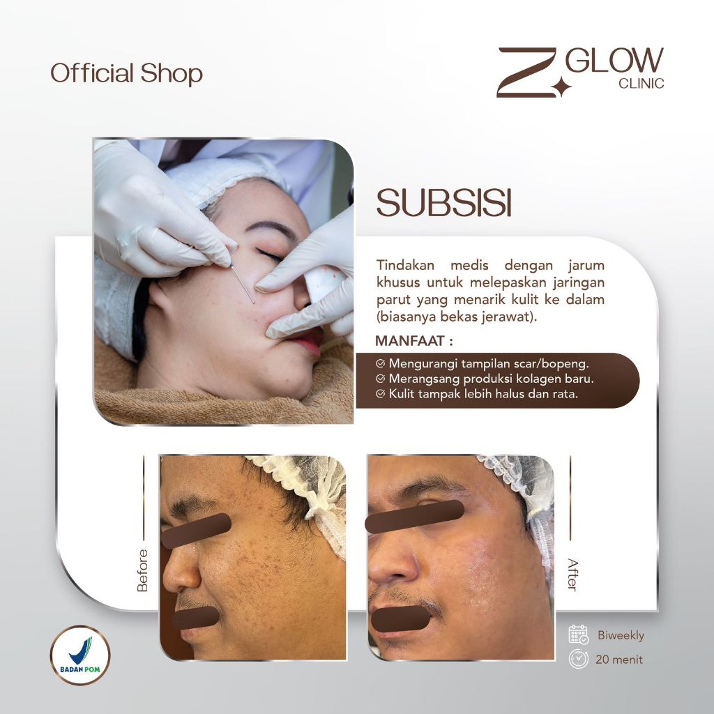 ZGLOW SUBSISI