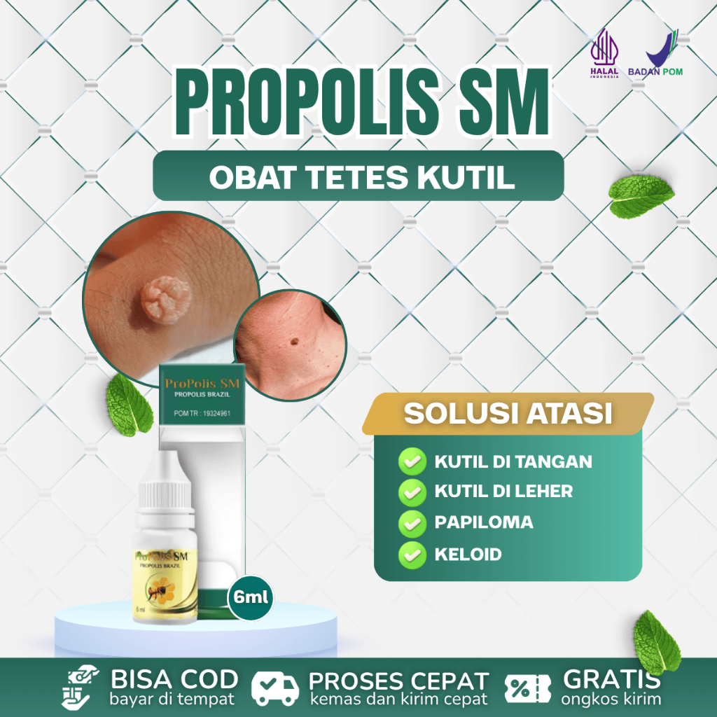 Obat Tetes Kutil, Papiloma, Kutil Di Tangan, Kutil Di Leher, Kutil Di Kaki, Keloid - Propolis SM 6ml
