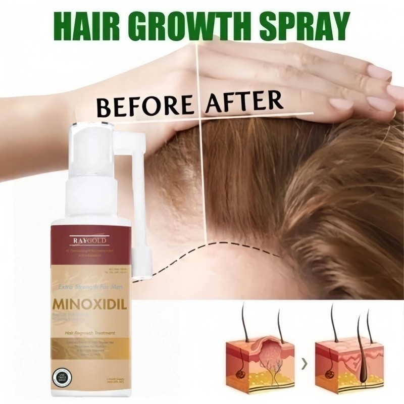 MINOXIDIL 5%for WOMEN penumbuh rambut with Ginseng extract 60ml - RAYGOLD - MINOX MINOKSIDIL anti ro