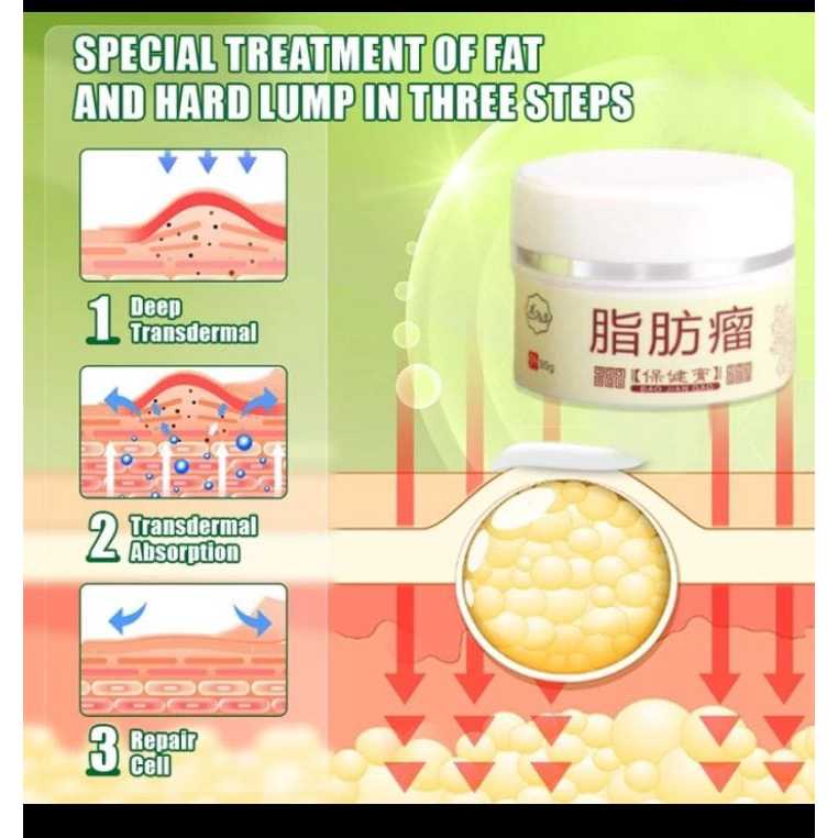 Obat Benjolan Lipoma Obat herbal Cina Krim lipoma 30g Perawatan punggung/leher/paha Kanker Tumor Kel