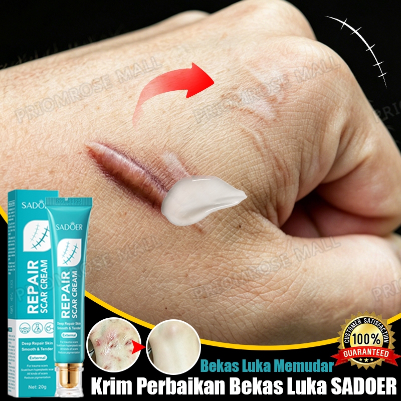 Salep penghilang bekas luka penghilang bekas luka hitam koreng salep bekas luka original keloid peng