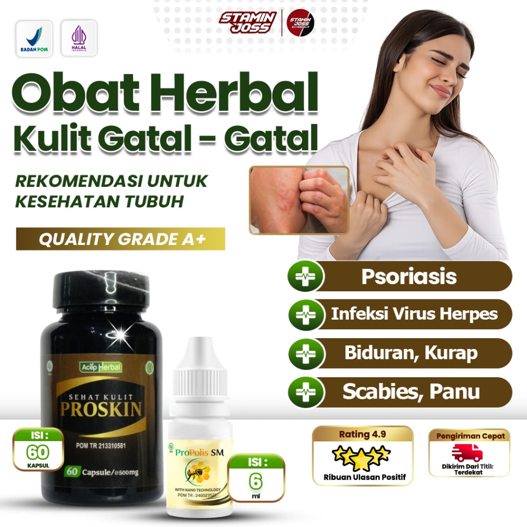 Salep Obat Gatal Kulit Selangkangan Herpes Borok Budug Cacar Air dan Api Cenang Eksim Kurap Kutu Air