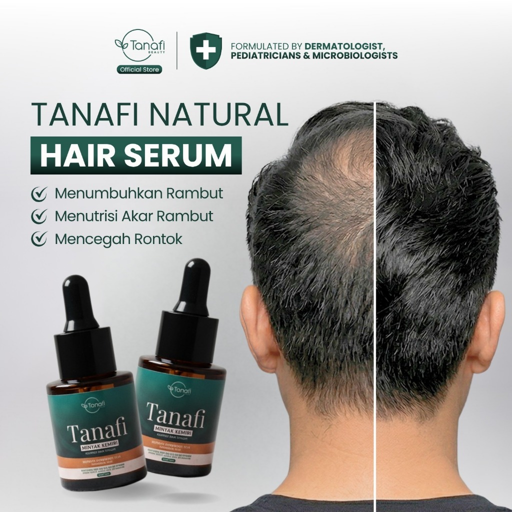 Tanafi Minyak Rambut Pria BPOM – Membantu Menumbuhkan Rambut Baru & Menutrisi Akar Rambut
