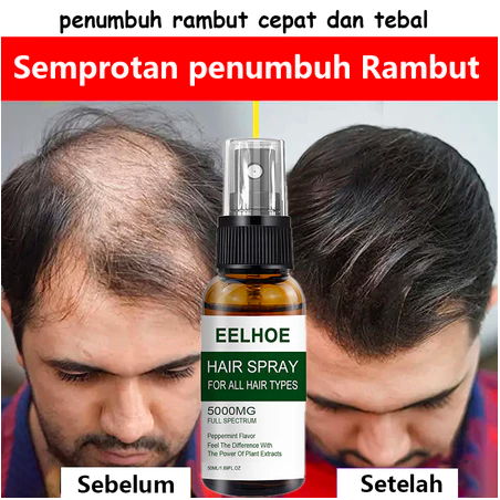 Rambut Botak Serum Penumbuh Rambut Hair Growth Serum