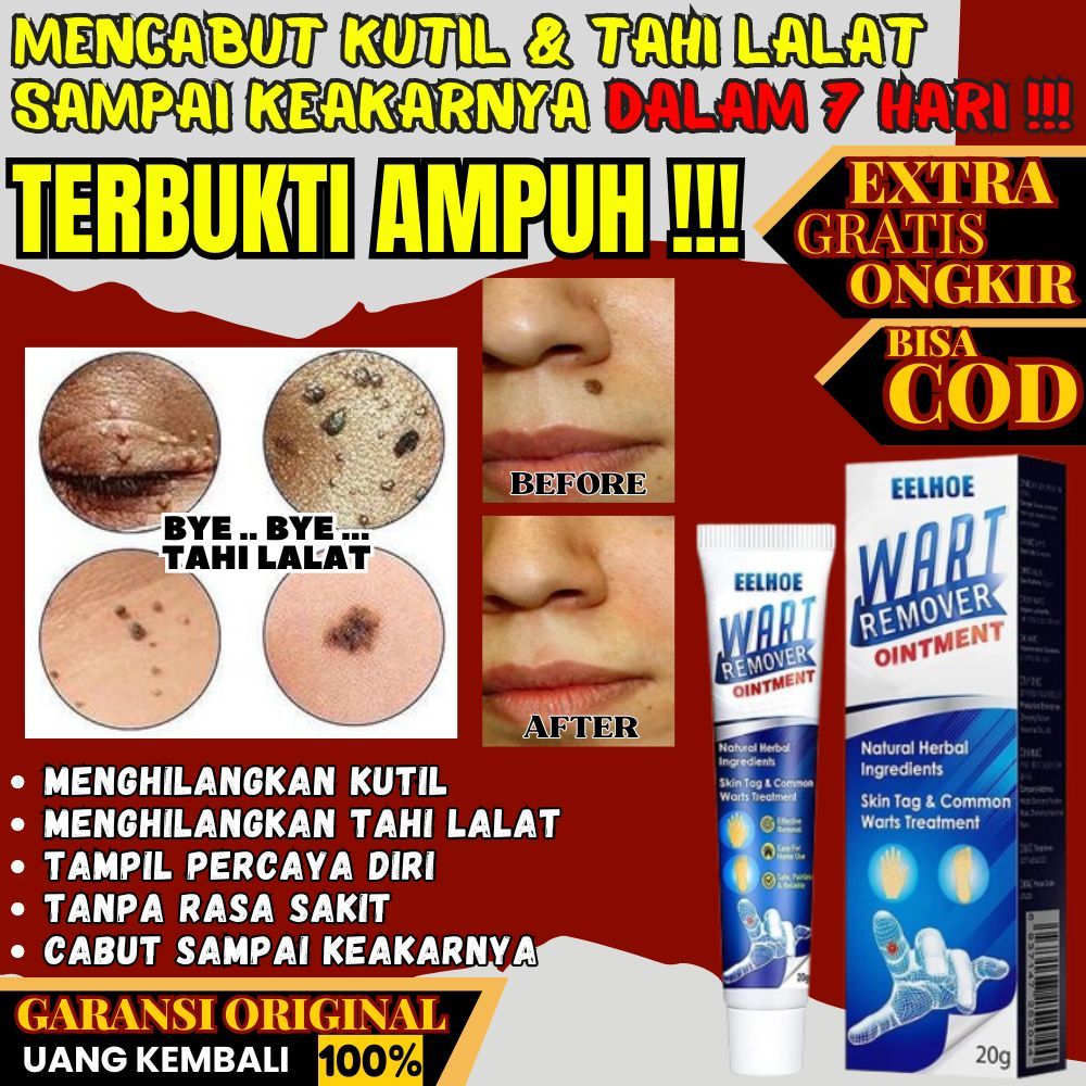 SUMIFUN EELHOE WART REMOVER CREAM PENGHILANG KUTIL DAN TAHI LALAT