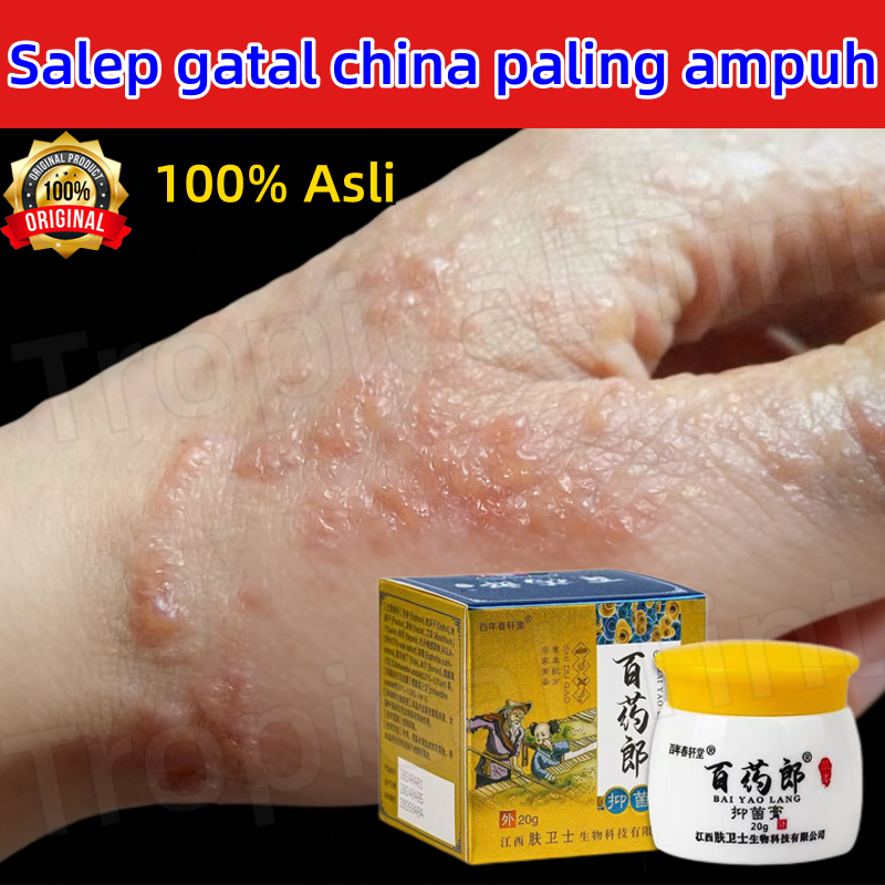 Salep gatal china paling ampuh salep gatal jamur selangkanga Krim Eksim Bayi dan Anak Obat gatal sel