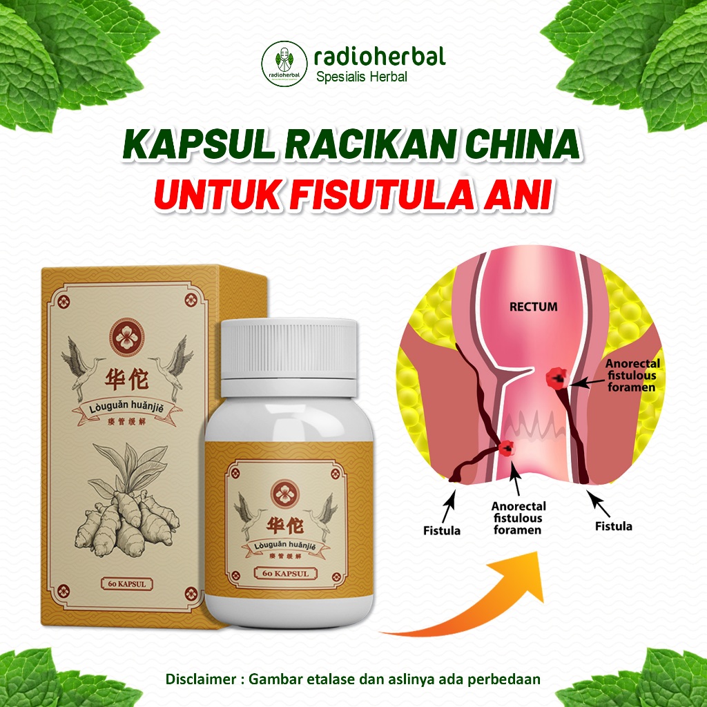 Obat Fistula Ani | Herbal Fistula Ani | Racikan Herbal China | Louguan Huanjie | Fistula | Membantu 