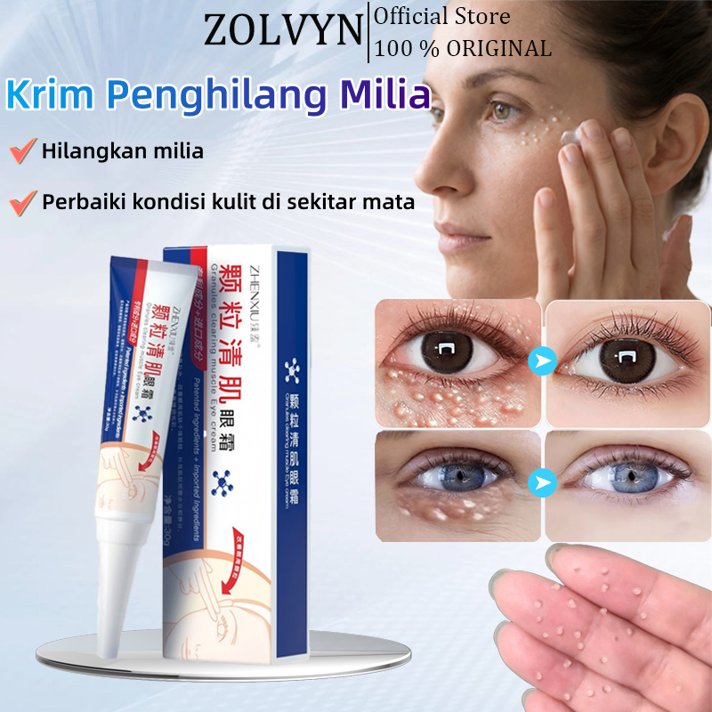 Krim Penghilang Milia Obat Milia di Mata Salep Mata Bintitan Obat Milia untuk Bawah Mata Milia remov