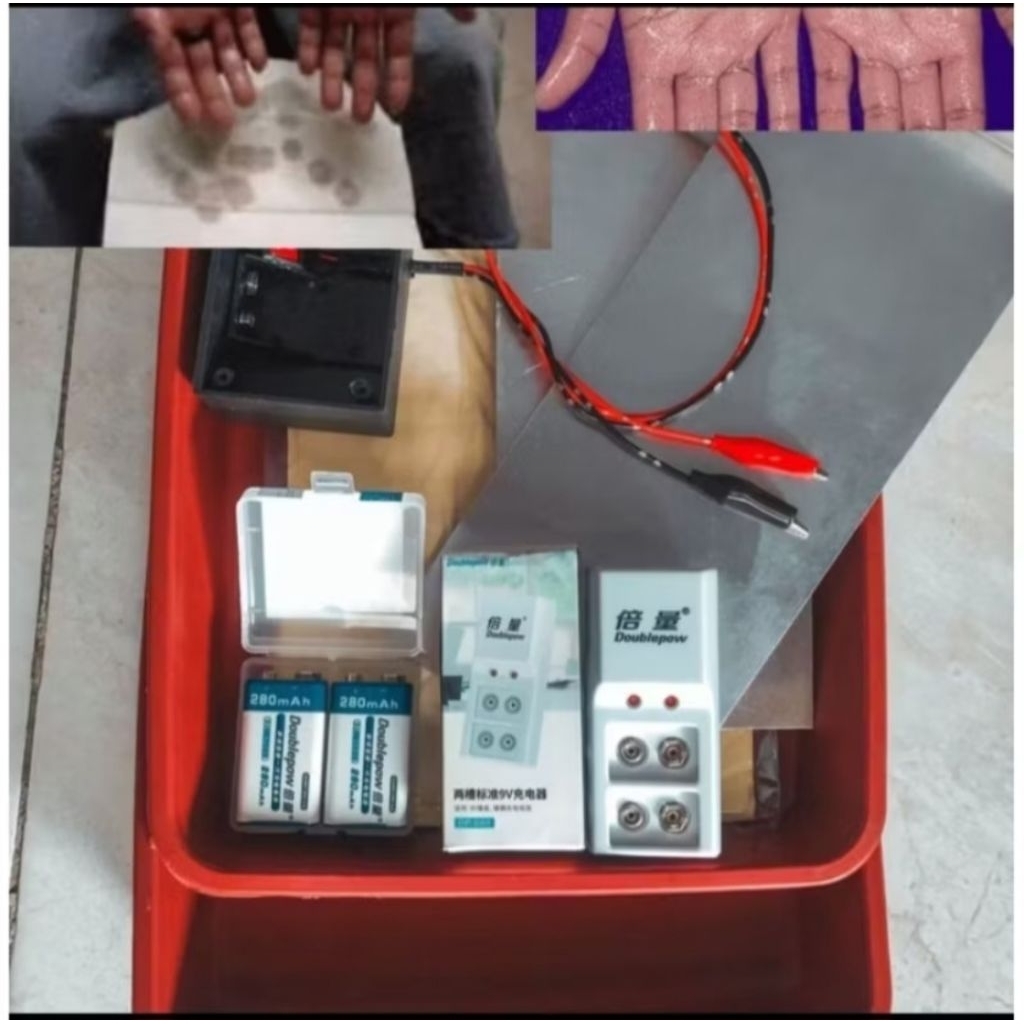Alat Terapi Therapy Iontophoresis Keringat Kringat Berlebihan Di Telapak Tangan Dan Telapak Kaki Ata