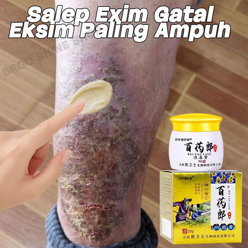Salep Exim Gatal Eksim Paling Ampuh Salap Kurap 0bat Gatal Di Selangkangan Badan Meredakan Miss V Ga