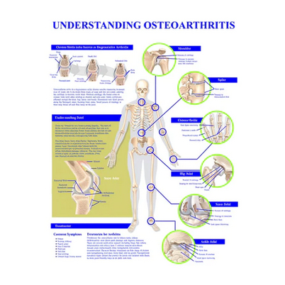 POSTER SISTEM SENDI UNDERSTANDING OSTEOARTHRITIS