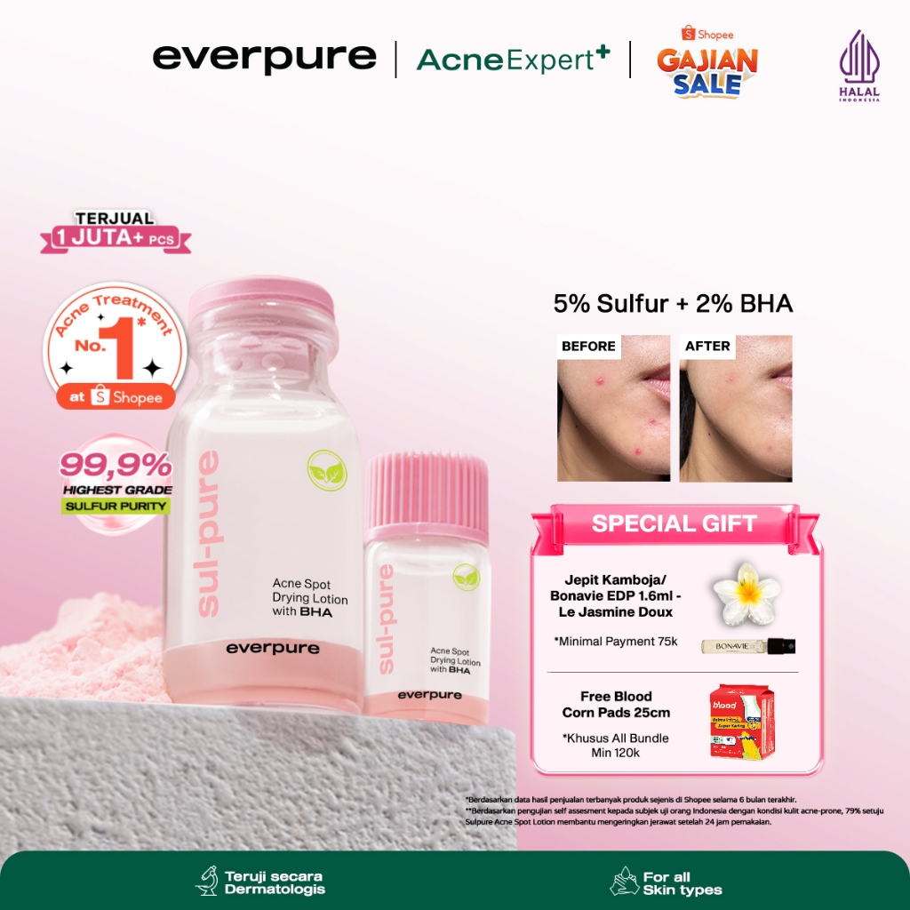 [SPECIAL AFFILIATE] EVERPURE  Sulpure Acne Spot Drying Lotion with BHA - Obat Totol Mengeringkan Jer