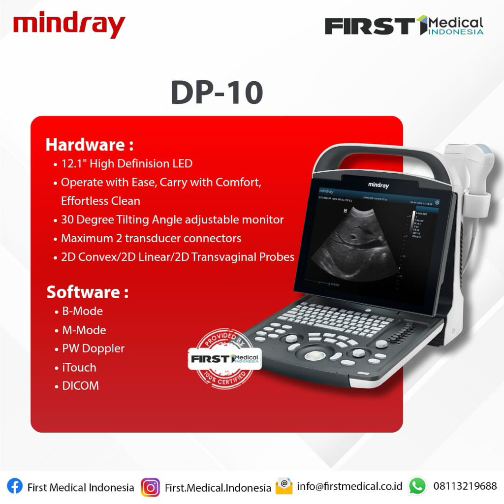 USG Portable Mindraay DP10