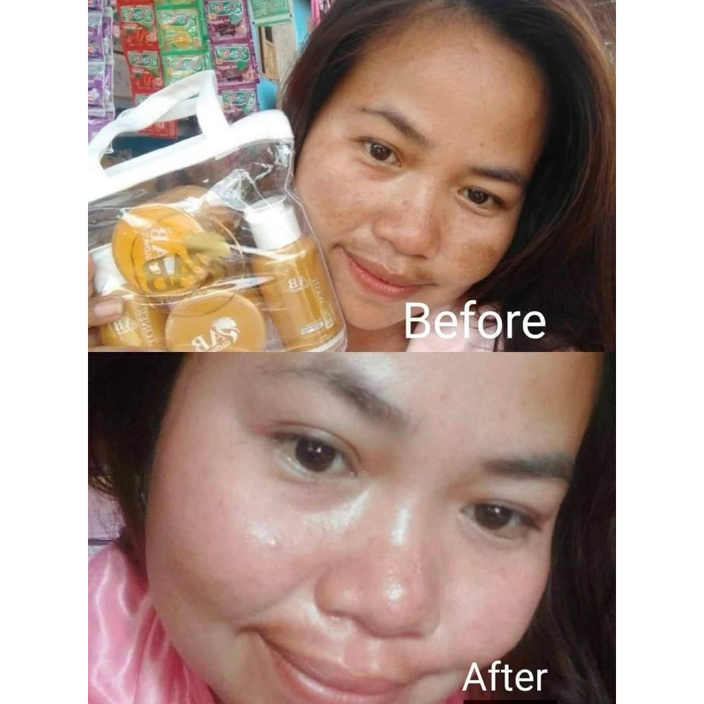 ab glow up