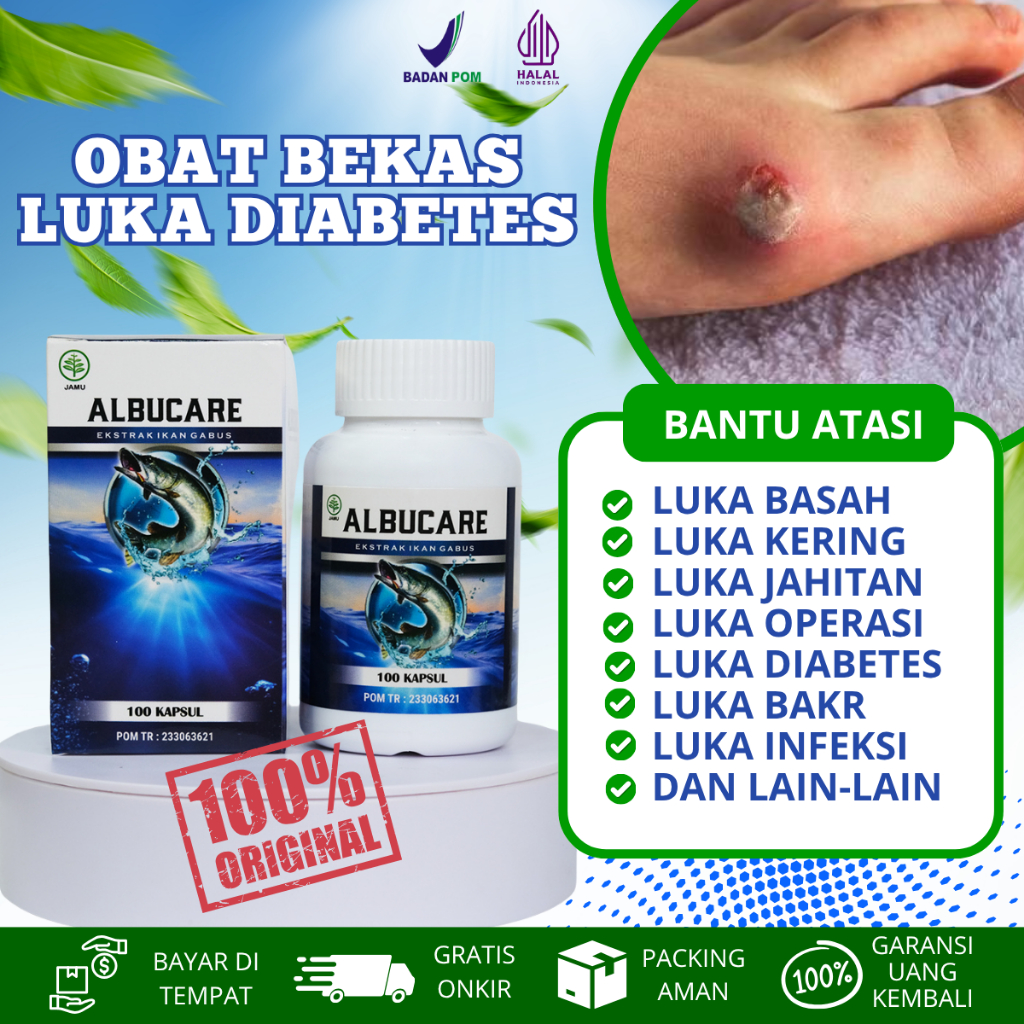 Obat Luka Diabetes Kering Luka Diabetes Basah, Obat pengering Luka Diabetes, Obat Luka Diabetes Agar
