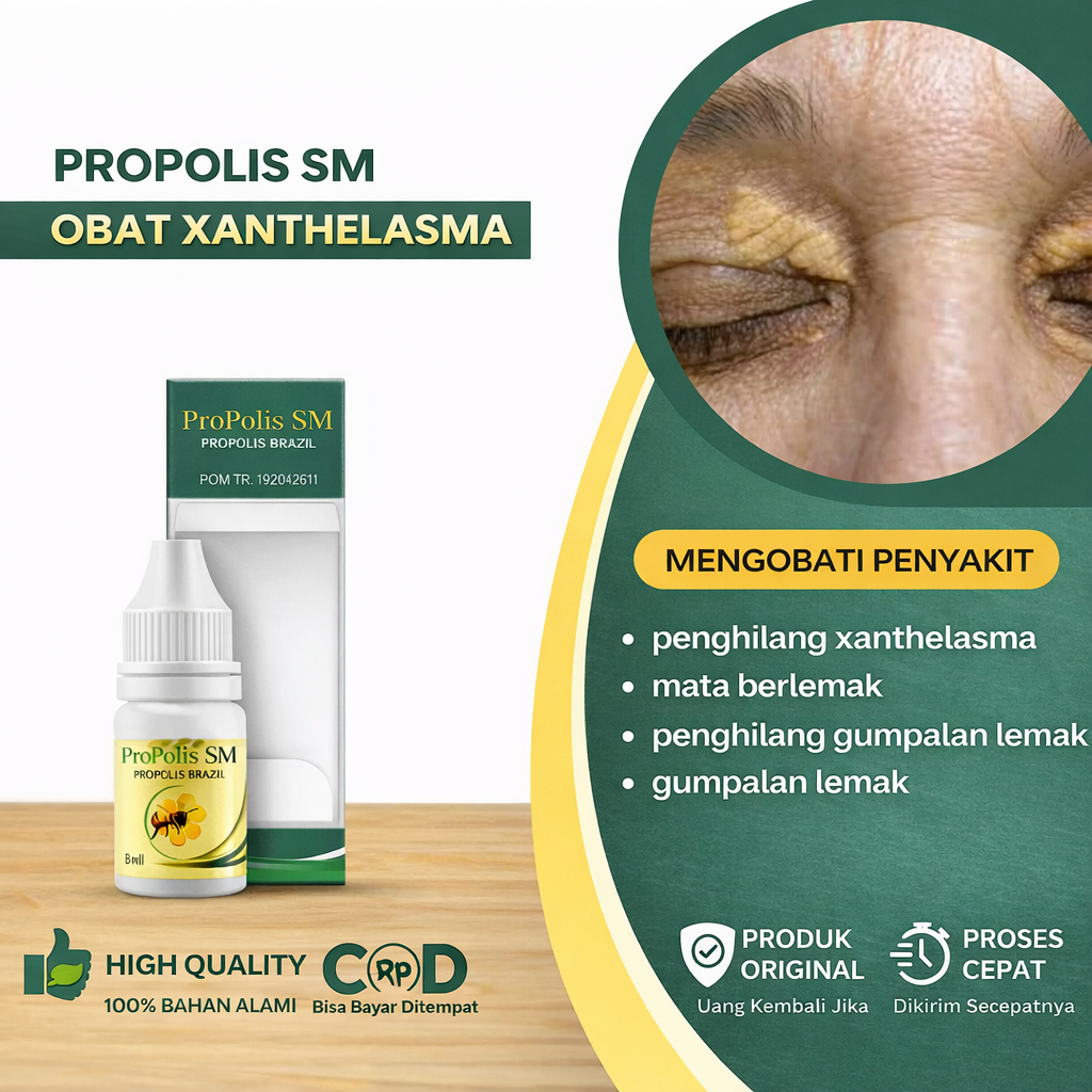 Propolis SM Original – Herbal Alami untuk Perawatan Xanthelasma