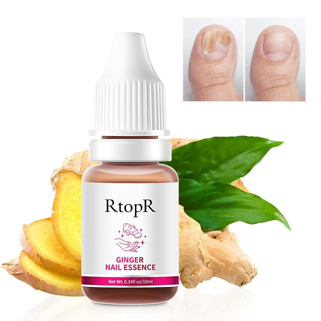 RtopR Jahe Antibakteri Perawatan Kuku Onikomikosis Paronychia Anti Infeksi Kuku