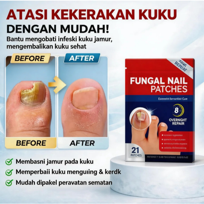 Obat Jamur Kuku Ampuh Obat Cantengan Kuku Kaki Tangan Perawatan Kuku