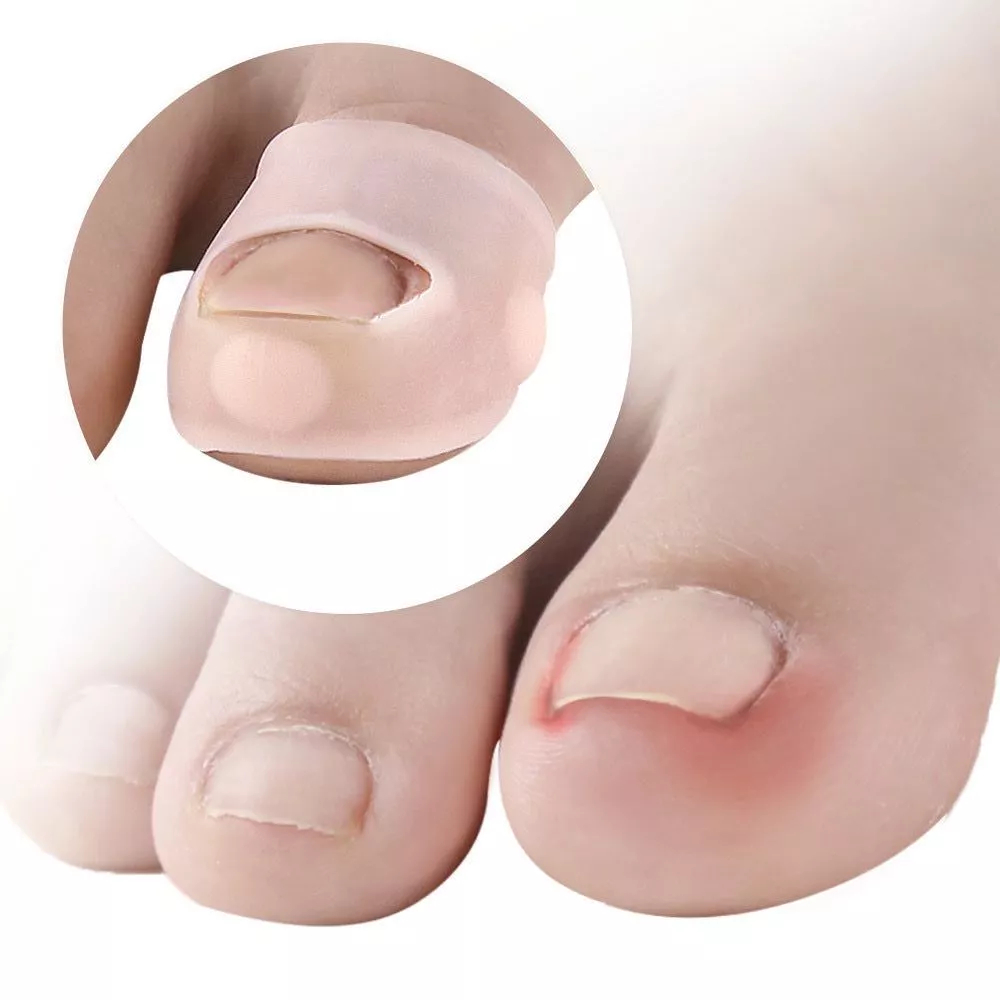 SILIKON PELINDUNG KAKI JARI JEMPOL ANTI LUKA PELINDUNG JEMPOL KAKI DARI KUKU DESIGN DENGAN BUTIRAN G