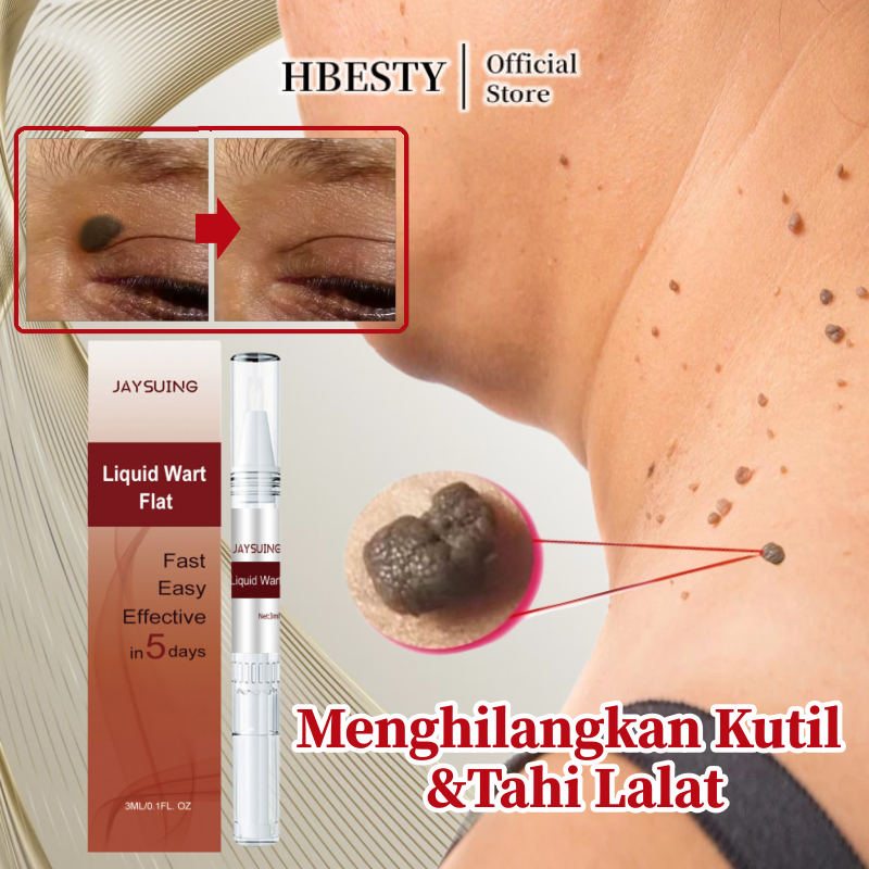 HBESTY Penghilang kutil Penghilang tahi lalat di wajah Penghilang kutil ampuh Kutil dan tahi lalat p
