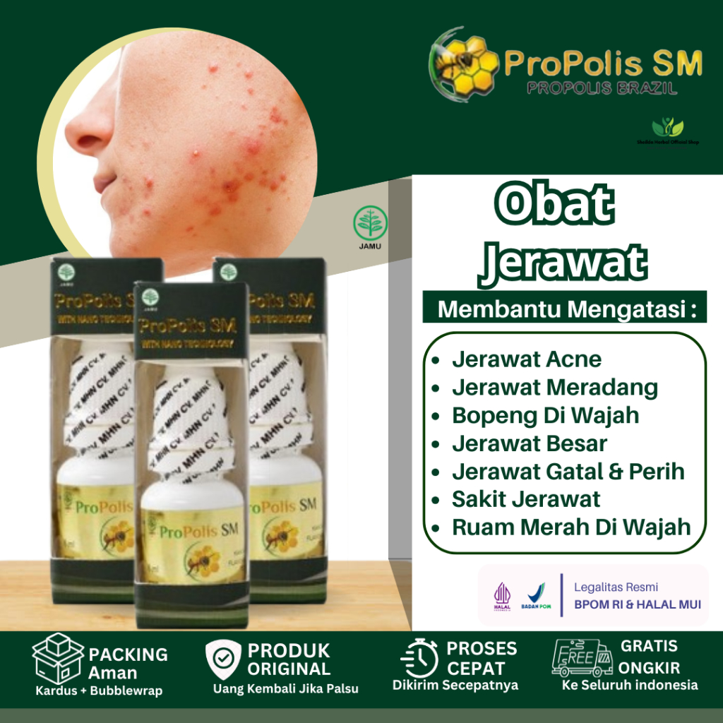 Propolis SM Jerawat Batu, Pembersih Jerawat Di Pipi, Dagu, Jidat, Bintik Hitam Bekas Jerawat, Jerawa