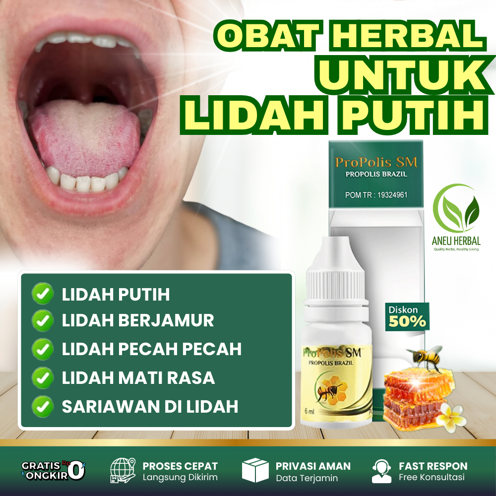 Propolis SM - Obat Penghilang Lidah Putih, Jamur Lidah, Lidah Pecah Pecah, Lidah Pahit