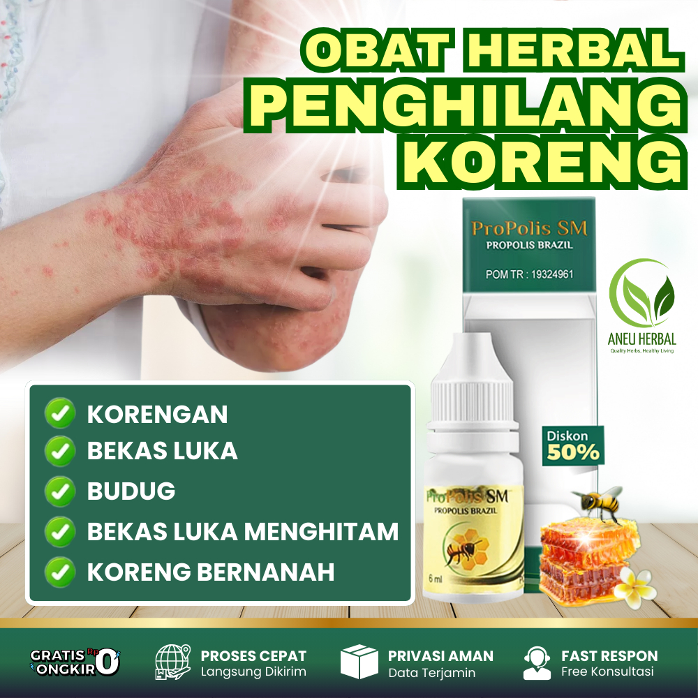 Propolis SM Obat Herbal Penghilang Koreng Penghilang Bekas Luka Hitam Penghilang Koreng Bernanah Pen