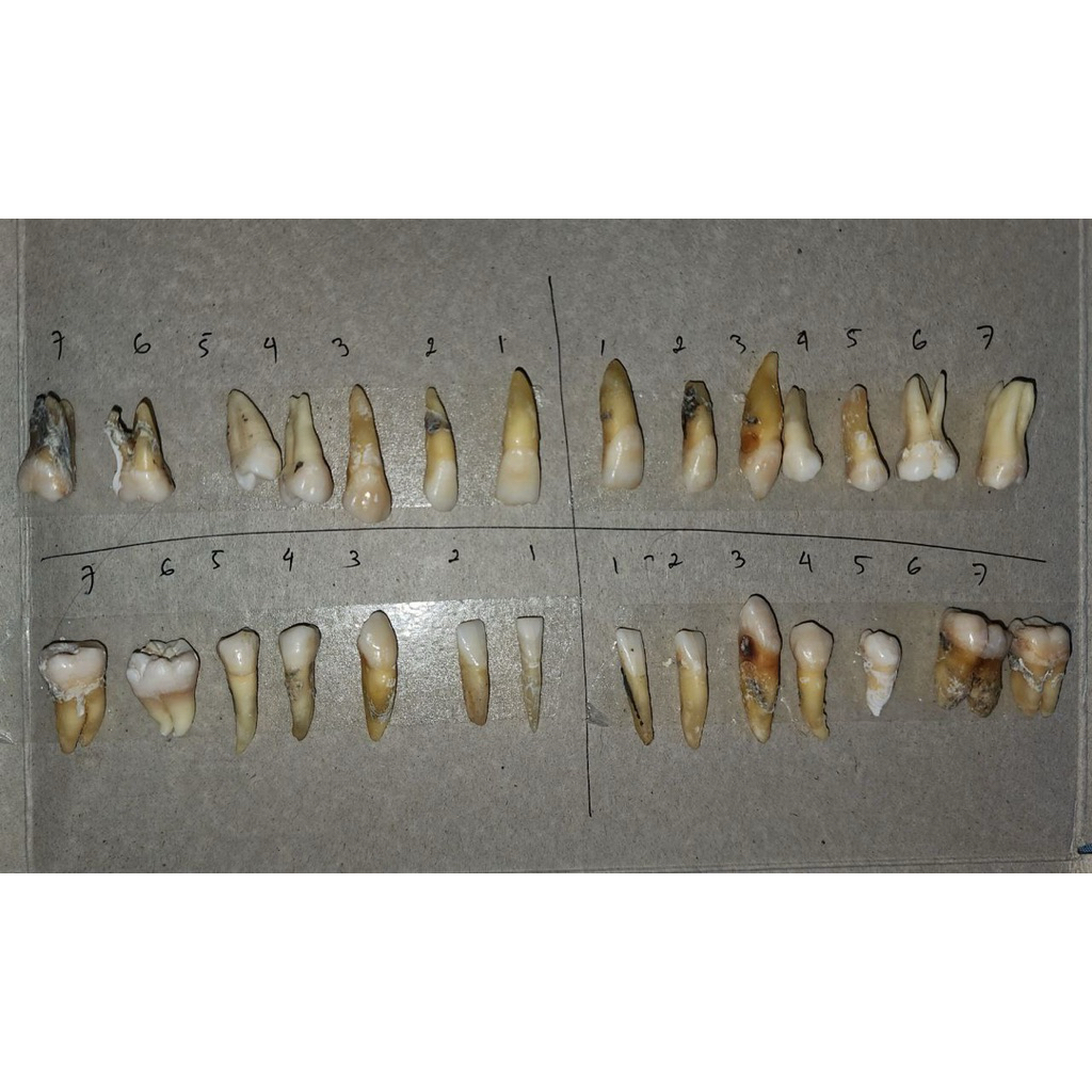 unsur gigi permanen/gigi dewasa lengkap