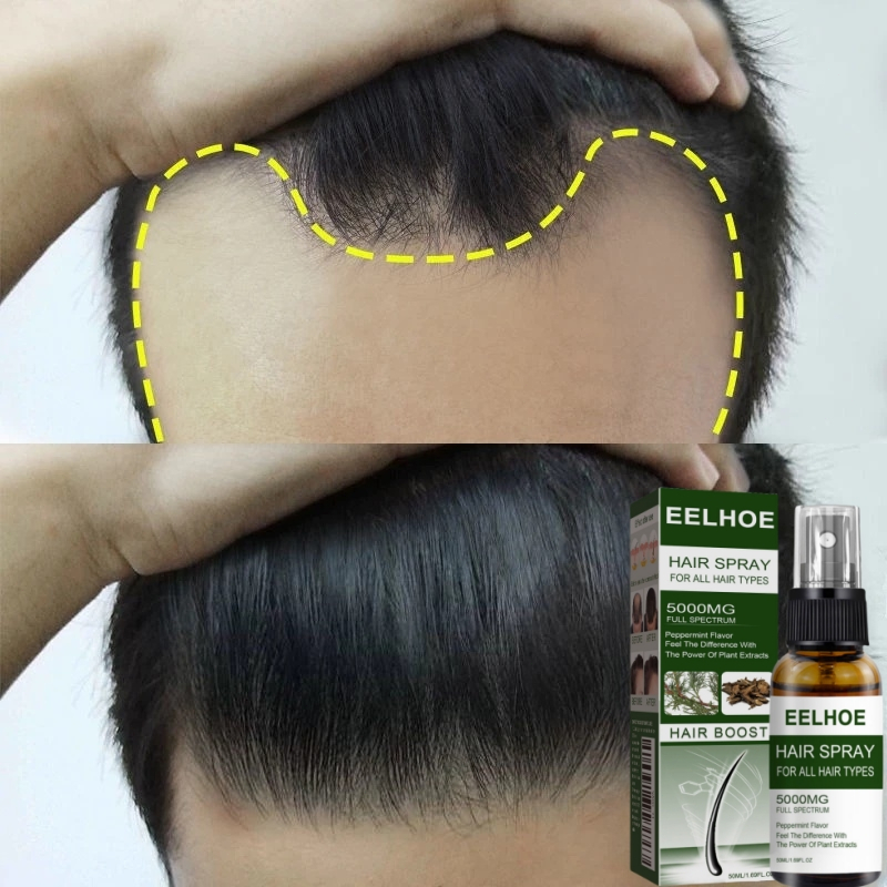 Beli 3 gratis 2 Semprotan Rambut Alami untuk Pertumbuhan Rambut Cepat, Mencegah Kebotakan, Serum Per