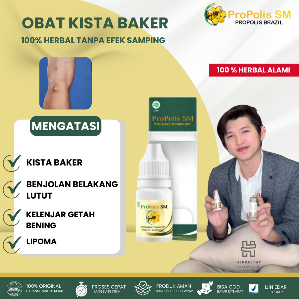 Obat Benjolan Lutut, Kista Baker Benjolan Belakang Lutut Obat Benjolan Di Belakang Lutut Kiri/Kanan 