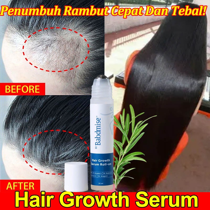 Serum Rambut Rontok Hair Tonic Penumbuh Rambut Serum Rambut Roller 3% Rosemary Oil Obat Penumbuh Ram