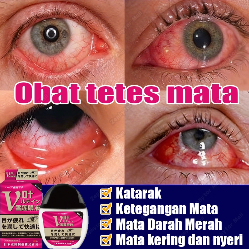 tetes mata jepang 15ml obat mata katarak obat sakit mata obat mata minus tetes mata kering/merah/bur